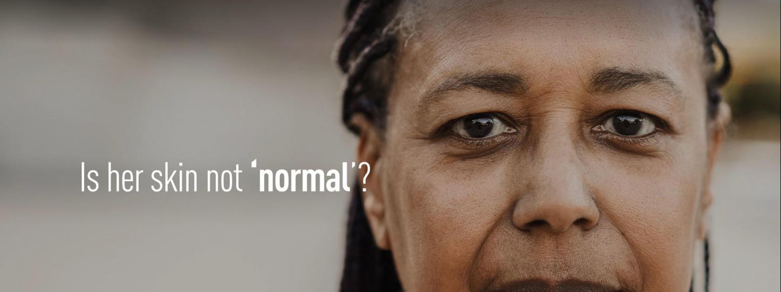 Unilever removed "normal," gained 5.5B impressions